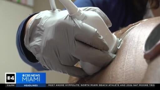 Birth rate for women over the age of 35, or mature pregnancies, is rising — CBS Miami, Delray Beach Health news
