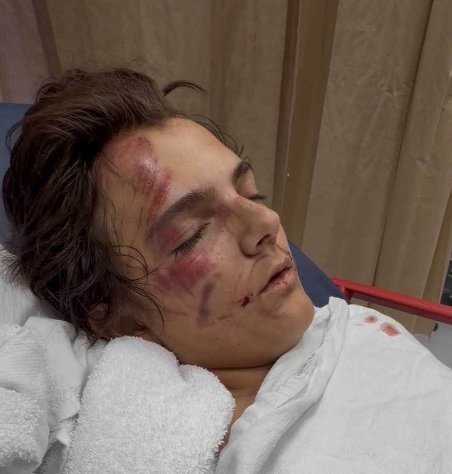 Father of boy hit by SUV in Boynton Beach urges drivers to be more careful — Delray Beach Community news